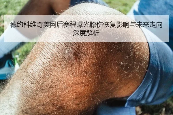 德约科维奇美网后赛程曝光膝伤恢复影响与未来走向深度解析